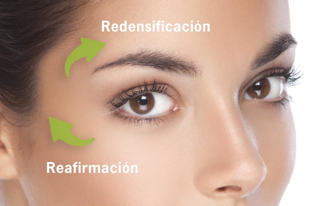 ¿Se pueden eliminar las bolsas de ojos? ¿Existe alternativa a la cirugía de párpados para abrir la mirada?